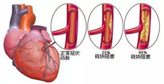 青岛地区的人可以补硒吗