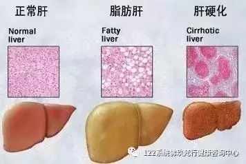 补硒能降低转氨酶吗孕妇