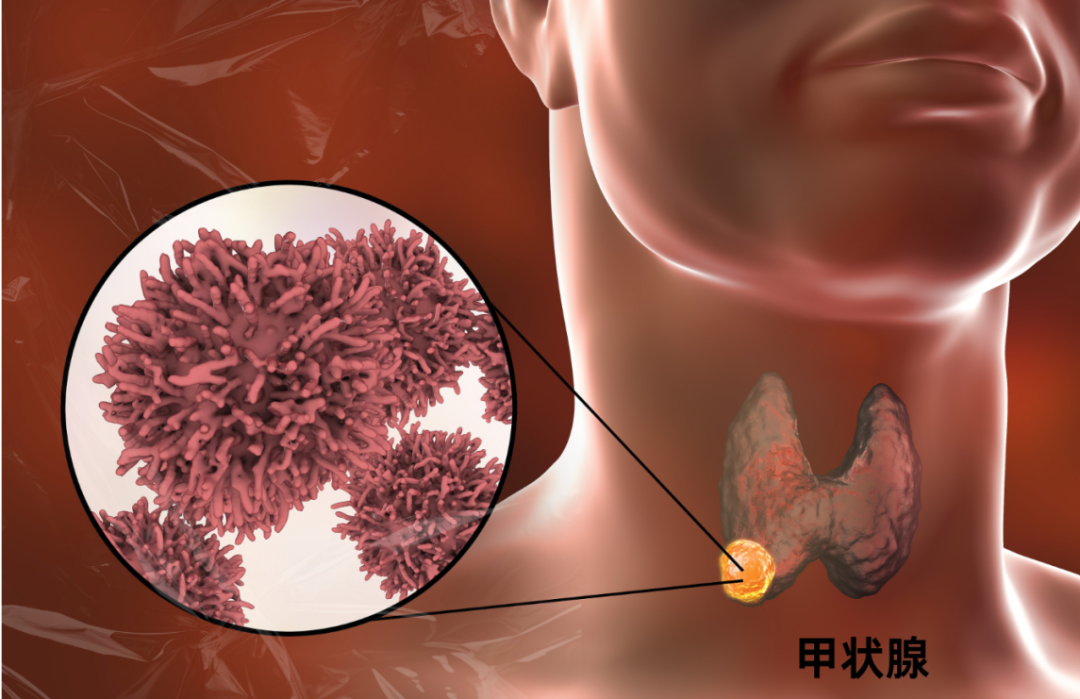 甲状腺手术后需要补硒吗