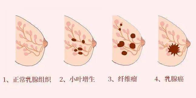 科学补硒配方食品有那些