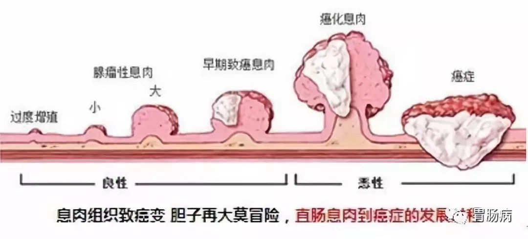 胃息肉手术后可以补硒吗