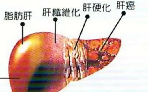 为什么说肝脏不好要补硒