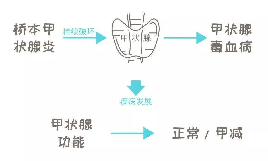 桥本氏甲状腺炎补硒剂量