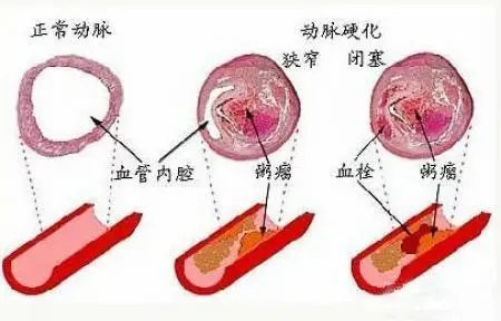 补硒又补锌的药物有哪些