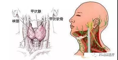 桥本甲状腺炎可以补硒么