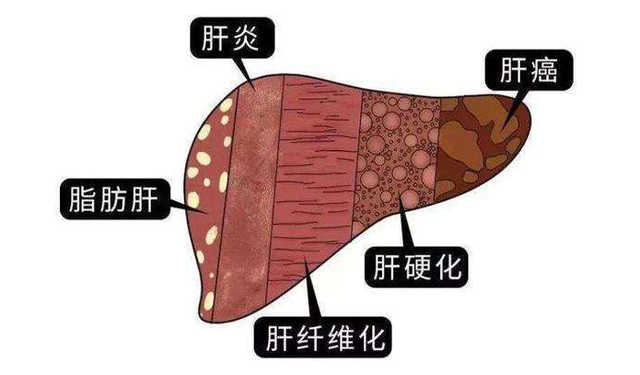 中年女性要不要补麦芽硒