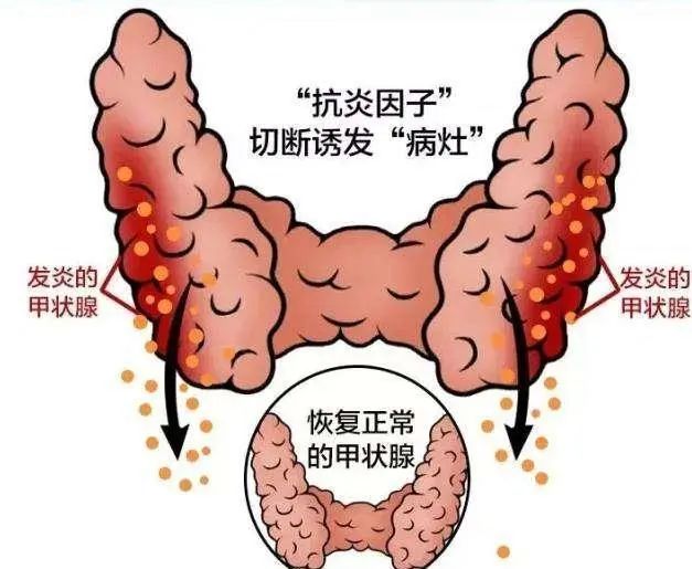 治疗甲状腺癌可以补硒吗