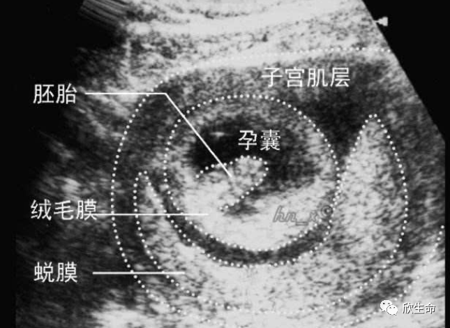 怀孕期间补多少硒最好呢