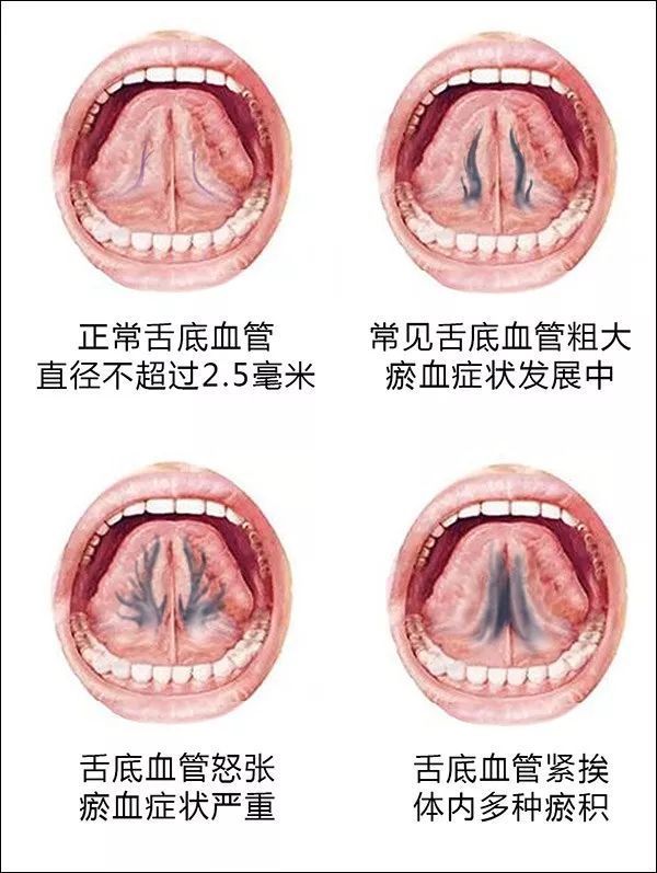 微创手术补硒吗有危害吗