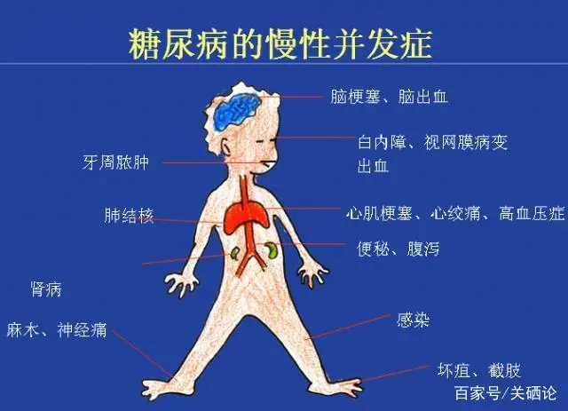 补硒为什么能预防糖尿病