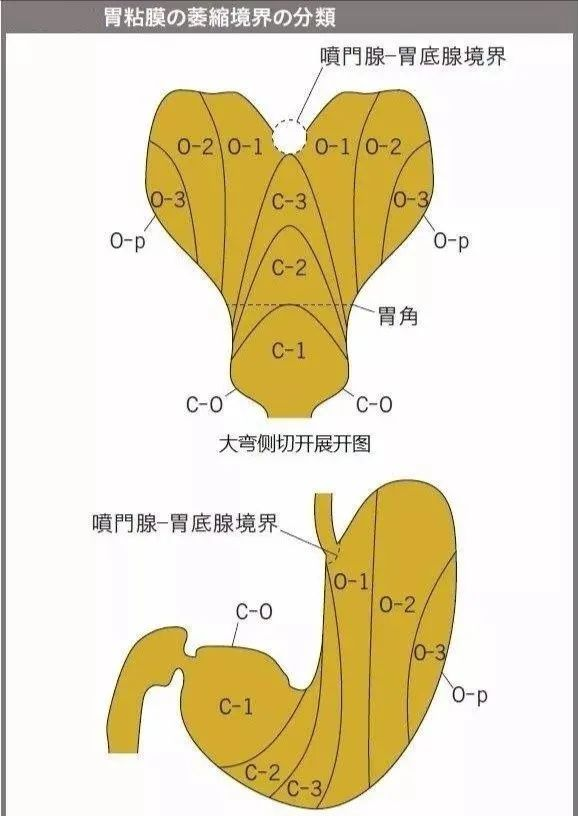 萎缩性胃炎怎样补硒的呢