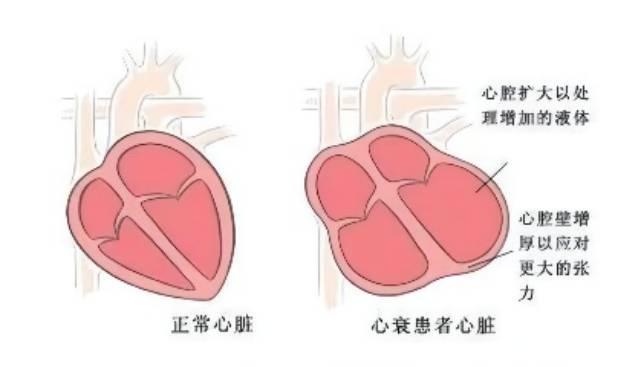 硒补多了会甲减吗怎么办