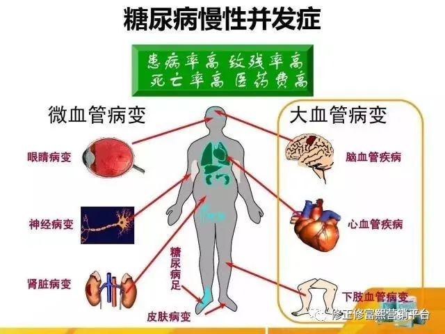 一切慢性疾病都必须补硒