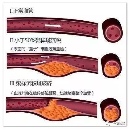 人们所说的富硒产品是指