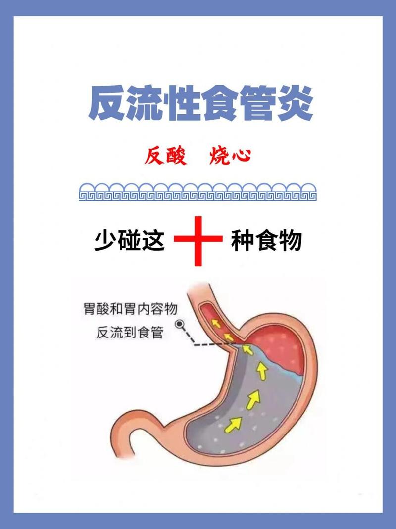 反流性食管炎能吃硒维康