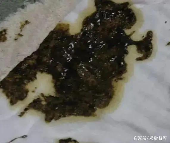 锌硒宝吃过之后大便黑色