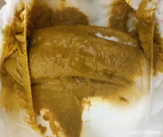 锌硒宝吃过之后大便黑色