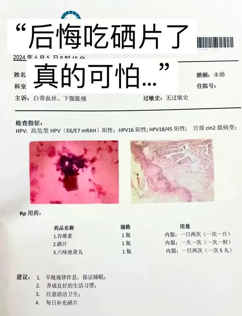 熬夜吃锌硒宝可以吗女性